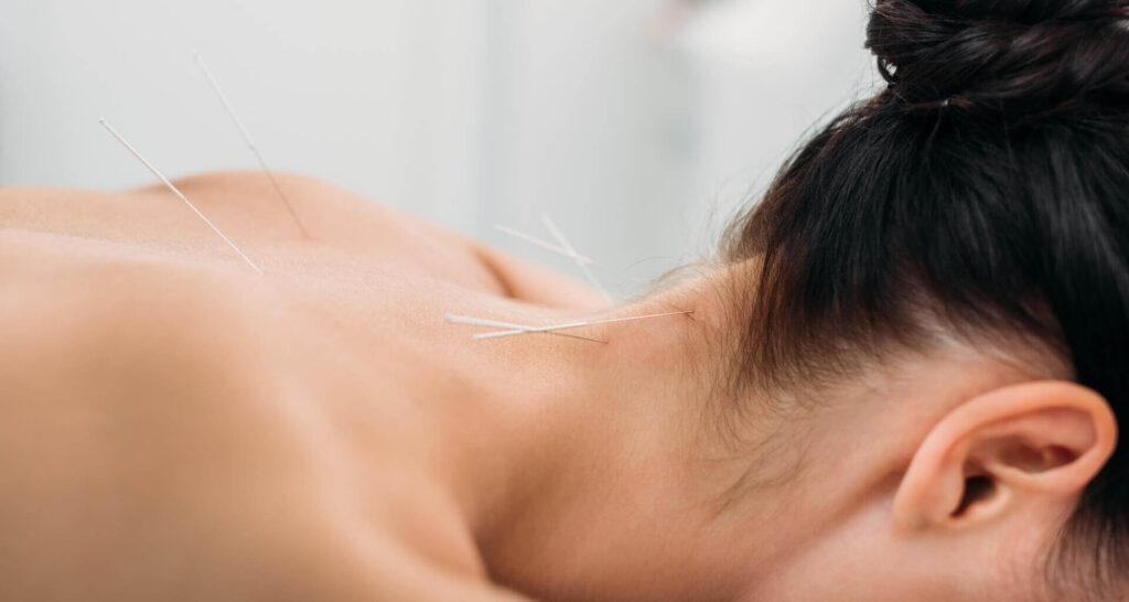 accupuncture banner 01